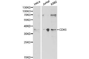 Western blot analysis of extracts of various cell lines, using CDK6 antibody. (CDK6 抗体)