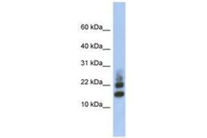 Image no. 1 for anti-Ribosomal Protein S15a (RA) (AA 71-120) antibody (ABIN6744019) (RPS15A 抗体  (AA 71-120))