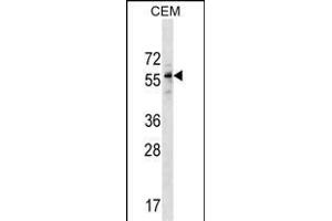 DPH2 Antibody (N-term) (ABIN1538986 and ABIN2849764) western blot analysis in CEM cell line lysates (35 μg/lane). (DPH2 抗体  (N-Term))