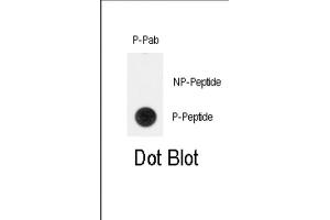 Dot Blot (DB) image for anti-Telomerase Reverse Transcriptase (TERT) (pTyr707) antibody (ABIN3001892) (TERT 抗体  (pTyr707))