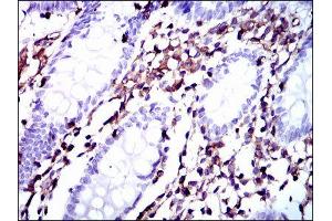 Immunohistochemistry (IHC) image for anti-Moesin (MSN) antibody (ABIN1844415) (Moesin 抗体)