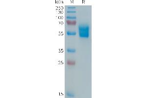 Human APO-1 Protein, hFc Tag on SDS-PAGE under reducing condition.