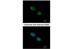 ICC/IF Image Immunofluorescence analysis of methanol-fixed HeLa, using TXNDC1, antibody at 1:500 dilution. (TMX1 抗体  (C-Term))