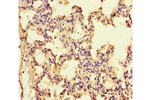 Immunohistochemistry of paraffin-embedded human lung tissue using ABIN7156789 at dilution of 1:100 (IL-13 抗体  (AA 30-125))