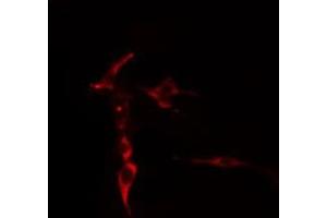 ABIN6276893 staining  COLO205 cells by IF/ICC. (Syndecan 2 抗体  (C-Term))