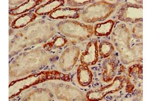 Immunohistochemistry (IHC) image for anti-Cytochrome P450, Family 11, Subfamily B, Polypeptide 2 (CYP11B2) (AA 25-503) antibody (ABIN7149198)