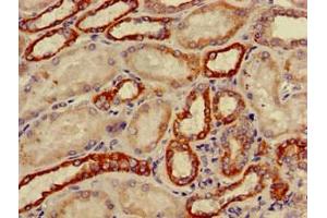 Immunohistochemistry of paraffin-embedded human kidney tissue using ABIN7149198 at dilution of 1:100 (CYP11B2 抗体  (AA 25-503))