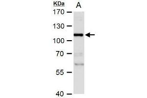 WB Image NBS1 antibody detects NBS1 protein by western blot analysis. (Nibrin 抗体)