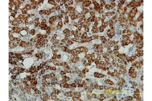 Immunoperoxidase of monoclonal antibody to ALDH4A1 on formalin-fixed paraffin-embedded human liver tissue. (ALDH4A1 抗体  (AA 1-563))