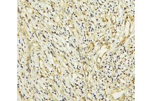 anti-Coiled-Coil Domain Containing 36 (CCDC36) (AA 172-472) antibody