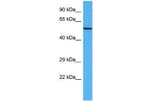 Host:  Mouse  Target Name:  DCT  Sample Tissue:  Mouse Skeletal Muscle  Antibody Dilution:  1ug/ml (DCT 抗体  (Middle Region))