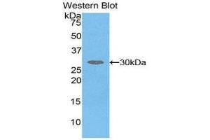 Western Blotting (WB) image for anti-serpin Peptidase Inhibitor, Clade D (Heparin Cofactor), Member 1 (SERPIND1) (AA 276-499) antibody (ABIN1859128) (SERPIND1 抗体  (AA 276-499))