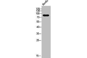 Western Blot analysis of HuvEC cells using DGK-β Polyclonal Antibody (DGKB 抗体  (C-Term))