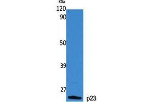 Western Blot (WB) analysis of specific cells using p23 Polyclonal Antibody. (CDK5R1 抗体  (Tyr579))