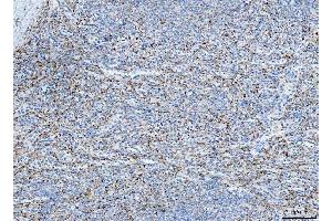 IHC analysis of FHL2 using anti-FHL2 antibody (ABIN7600782). (FHL2 抗体  (AA 234-279))