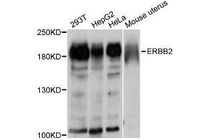 Western blot analysis of extracts of various cell lines, using ErbB2 antibody. (ErbB2/Her2 抗体  (C-Term))