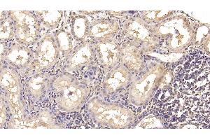 Immunohistochemistry (IHC) image for anti-Interleukin 18 (IL18) (AA 37-193) antibody (ABIN7426994)
