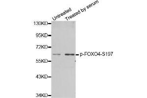 Western blot analysis of extracts from 293 cells using phospho-FOXO4-S197 antibody (ABIN2987524). (FOXO4 抗体  (pSer197))
