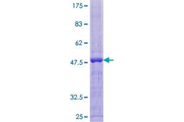 Triadin Protein (TRDN) (AA 1-167) (GST tag)