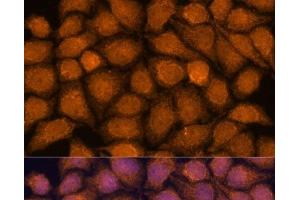 Immunofluorescence analysis of HeLa cells using TNFAIP8L2 Polyclonal Antibody at dilution of 1:100. (TNFAIP8L2 抗体)