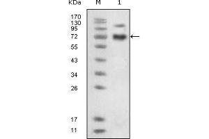 Western blot analysis using EphB4 mouse mAb against extracellular domain of human EphB4 (aa16-539). (EPH Receptor B4 抗体)