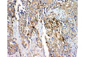 Immunohistochemistry (IHC) image for anti-Hydroxysteroid (17-Beta) Dehydrogenase 4 (HSD17B4) (AA 744-761), (C-Term) antibody (ABIN3044284)