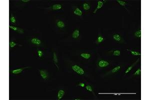 Immunofluorescence of purified MaxPab antibody to DUSP4 on HeLa cell. (DUSP4 抗体  (AA 1-394))