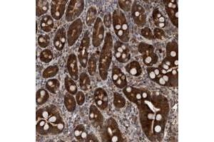 Immunohistochemical staining of human duodenum with TANC2 polyclonal antibody  strong cytoplasmic positivity in glandular cells. (TANC2 抗体)