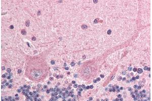Human Brain, Cerebellum (formalin-fixed, paraffin-embedded) stained with ING4 antibody ABIN292976 at 2. (ING4 抗体  (AA 164-175))