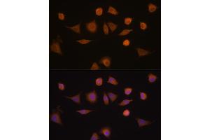 Immunofluorescence analysis of L929 cells using GST Rabbit pAb (8266) at dilution of 1:100 (40x lens).