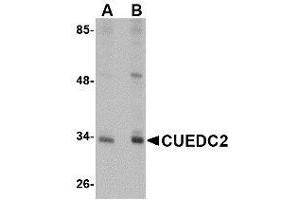 Western blot analysis of CUEDC2 in HeLa cell lysate with AP30262PU-N CUEDC2 antibody at (A) 1 and (B) 2 μg/ml. (CUEDC2 抗体  (C-Term))