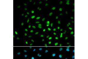 Immunofluorescence analysis of MCF-7 cells using LKB1 Polyclonal Antibody (LKB1 抗体)