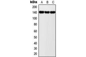 Western blot analysis of NOLC1 expression in MCF7 (A), SP2/0 (B), PC12 (C) whole cell lysates. (NOLC1 抗体  (C-Term))