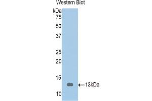 Western blot analysis of the recombinant protein. (Tropomodulin 1 抗体  (AA 39-138))