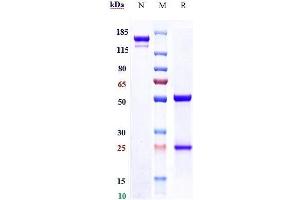 Anti-Fibronectin Reference Antibody (L19-TNF) on SDS-PAGE under reducing (R) condition.
