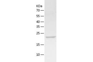 Western Blotting (WB) image for Brain Abundant, Membrane Attached Signal Protein 1 (BASP1) (AA 1-227) protein (His tag) (ABIN7286825) (BASP1 Protein (AA 1-227) (His tag))