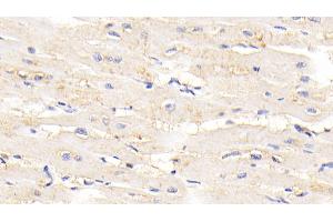 Detection of TTN in Human Cardiac Muscle Tissue using Polyclonal Antibody to Titin (TTN) (Titin 抗体  (AA 33779-34025))