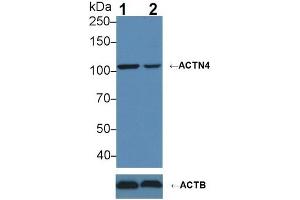 Western Blotting (WB) image for anti-Actinin, alpha 4 (ACTN4) (AA 1-269) antibody (ABIN7440797)