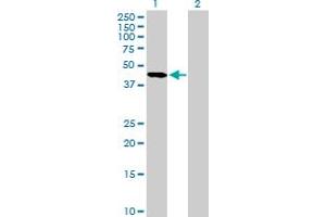 Western Blotting (WB) image for anti-serpin Peptidase Inhibitor, Clade A (Alpha-1 Antiproteinase, Antitrypsin), Member 5 (SERPINA5) (AA 17-406) antibody (ABIN518677)