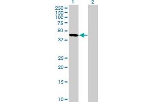 Western Blot analysis of SERPINA5 expression in transfected 293T cell line by SERPINA5 MaxPab polyclonal antibody. (SERPINA5 抗体  (AA 17-406))