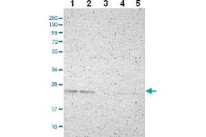Western blot analysis of Lane 1: RT-4 Lane 2: U-251 MG Lane 3: Human Plasma Lane 4: Liver Lane 5: Tonsil with PDDC1 polyclonal antibody ( Cat # PAB28008 ) at 1:100 - 1:250 dilution. (PDDC1 抗体)