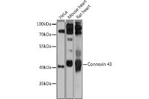 Western blot analysis of extracts of various cell lines, using Connexin 43 antibody (ABIN6131701, ABIN6141098, ABIN6141099 and ABIN6215448) at 1:1000 dilution. (Connexin 43/GJA1 抗体  (AA 233-382))