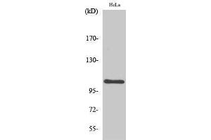Western Blotting (WB) image for anti-Nuclear Factor of kappa Light Polypeptide Gene Enhancer in B-Cells 1 (NFKB1) (Thr147) antibody (ABIN3180207) (NFKB1 抗体  (Thr147))