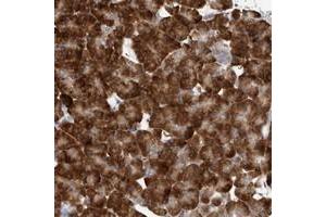 Immunohistochemical staining of human pancreas with ZNF341 polyclonal antibody  shows strong cytoplasmic positivity in exocrine cells at 1:200-1:500 dilution. (ZNF341 抗体)
