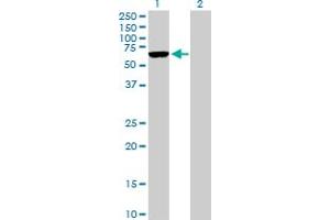 Western Blot analysis of ARMCX5 expression in transfected 293T cell line by ARMCX5 MaxPab polyclonal antibody. (ARMCX5 抗体  (AA 1-558))