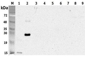 Western blot analysis using anti-CTRP5 (human), pAb  at 1:5'000 dilution. (CTRP5 抗体)