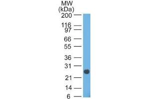 Western Blot analysis of human intestinal lysate using Lambda Light Chain Mouse Monoclonal Antibody (HP6054). (IgL 抗体)