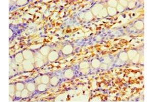 Immunohistochemistry of paraffin-embedded human colon tissue using ABIN7149619 at dilution of 1:100 (DHRS7 抗体  (AA 29-339))