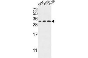 TSPAN2 Antibody (Center) western blot analysis in CEM,K562,HL-60 cell line lysates (35 µg/lane). (Tetraspanin 2 抗体  (Middle Region))