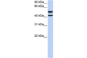 WB Suggested Anti-GNS Antibody Titration:  0. (GNS 抗体  (C-Term))